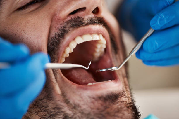 Best Emergency Dental Extractions in Luther, OK